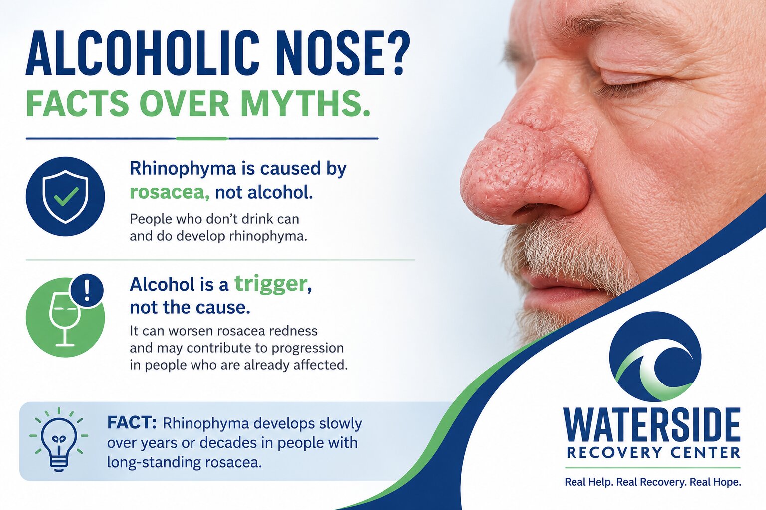 Alcoholic Nose Does Alcohol Really Cause Rhinophyma